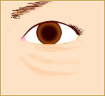 目元整形：目の下のたるみ解消