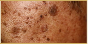 shimi_co2laser_case01