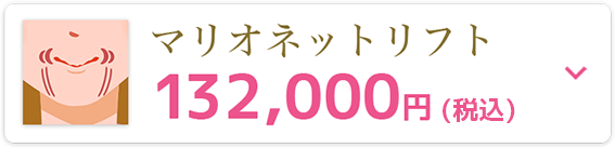マリオネットリフト132,000円(税込)